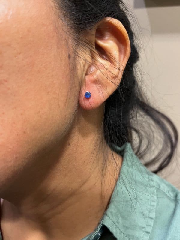 CLOUS SPINELLES — vue 2