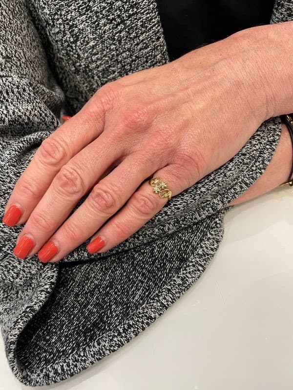 BAGUE 3 ORS NAPOLÉON III — vue 2
