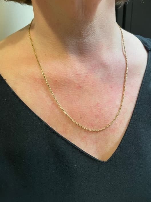 CHAINE MAILLE FORÇAT — vue 2