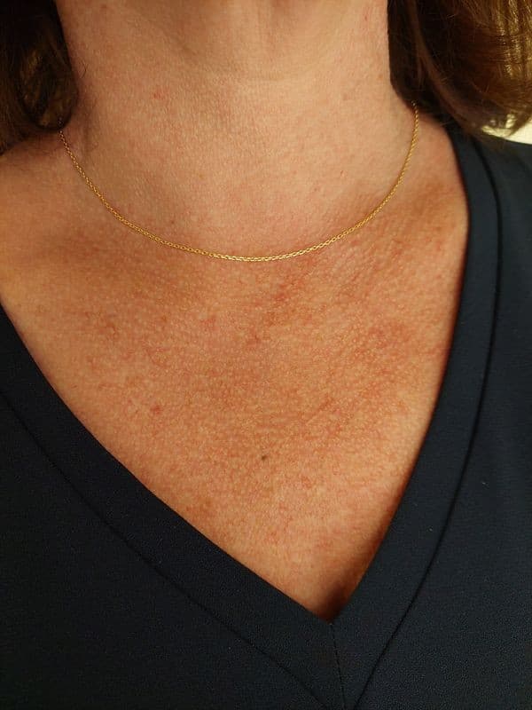 CHAINE MAILLE FORÇAT — vue 2